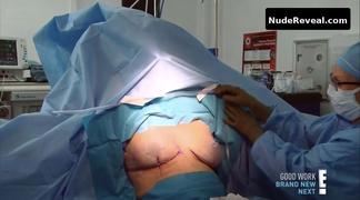 NICOLE EGGERT nude in Botched