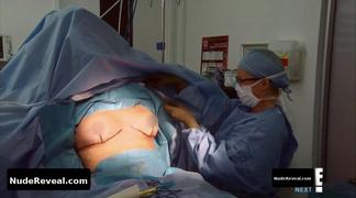 NICOLE EGGERT nude in Botched