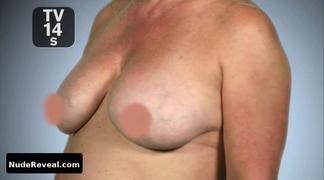 NICOLE EGGERT nude in Botched